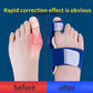 1PC/2pcs Big Bone Toe Bunion Splint Straightener Corrector Foot Pain Relief Hallux Valgus Feet Care Protector Foot Care Tools